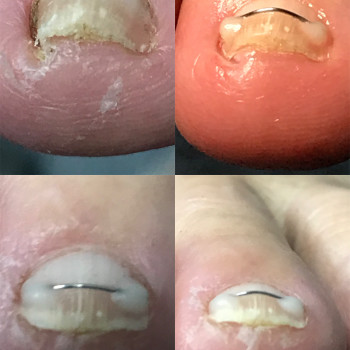 Ірина Абраменко, Кременчуг Фото - 3