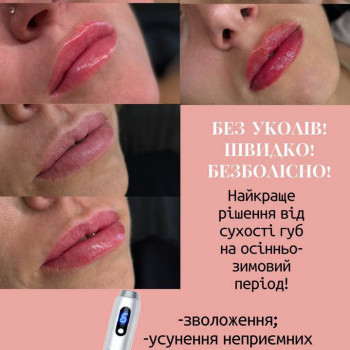 Мікронідлінг