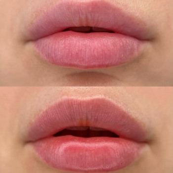 Ірина Білевіч-Чемерис, Київ Фото - 1