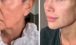 Полимолочная кислота Косметолог  Харьков