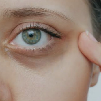 П'ять неочевидних причин темних кіл під очима🤔

 Чому ж з'являються кола під очима? І як зрозуміти...