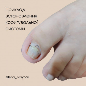  #встановленяКорекційноїсистеми