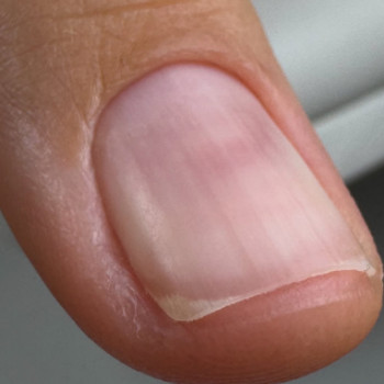 Наталія Кос, Київ Фото - 4