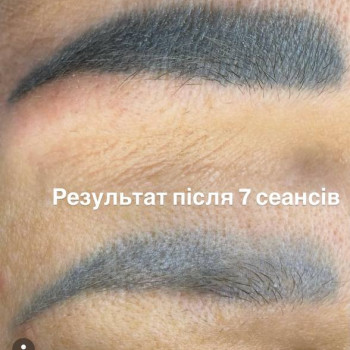 Між Нами, Киев Фото - 16