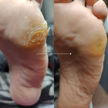 Елена Мазурак, Беляевка Фото - 2