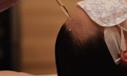 Японське СПА для голови — ритуал глибокого відновлення та гармонії Косметологический центр Клініка естетичної медицини Мирослави Новосільської Ужгород