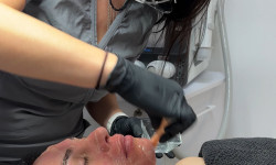 Инвазивная карбокситерапия Косметолог-эстетист Ольга Чернигов