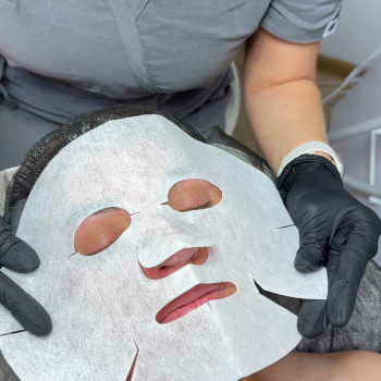 Инвазивная карбокситерапия
                    Косметолог-естетист Ольга Чернігів