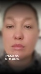 Спокусливі губи Косметолог-ін'єкціоніст Ольга Київ