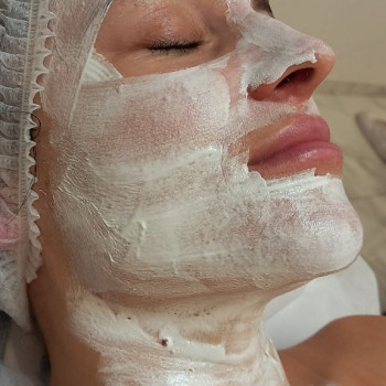 Комбінована чистка + хімічний пілінг