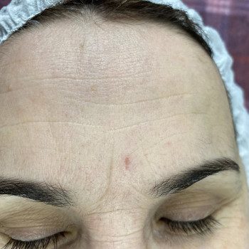 Моя робота, пластичний масаж обличчя- до масажу.