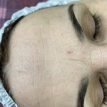 Пластичний масаж обличчя -До масажу ( моя робота)