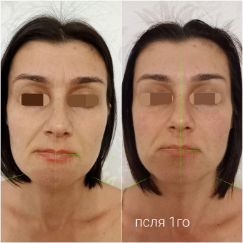 Масаж з остеопатичною корекцією