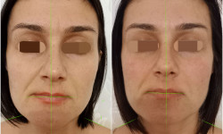 Масаж обличчя Косметолог-естетист Виктория Київ