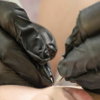 Електроепіляція
                    Електролог Алена Харків