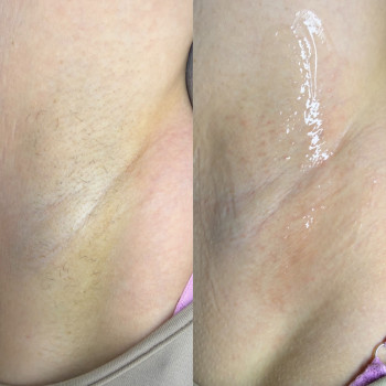 Альона Борзунова, Харків Фото - 3