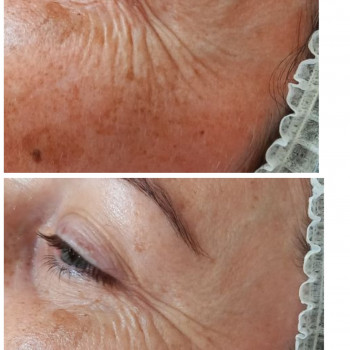 Людмила Патек, Рівне Фото - 7