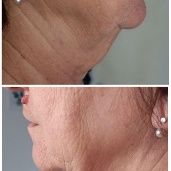 Людмила Патек, Рівне Фото - 6