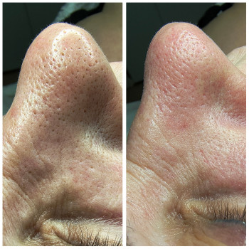 Людмила Патек, Рівне Фото - 4