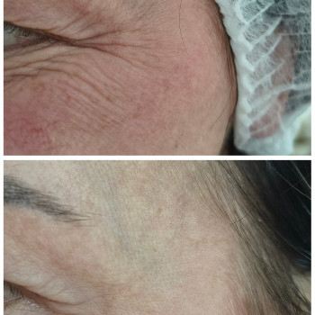 Людмила Патек, Рівне Фото - 3