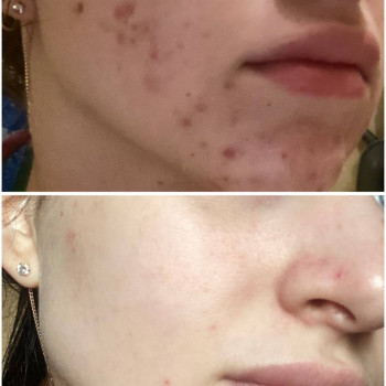 Людмила Патек, Рівне Фото - 24