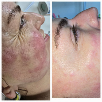 Фото из портфолио салона Косметичний кабінет (косметологический центр, Ровно)