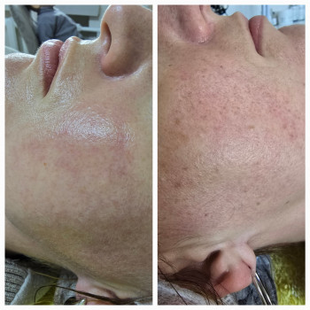 Фото из портфолио салона Косметичний кабінет (косметологический центр, Ровно)