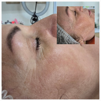 Фото из портфолио салона Косметичний кабінет (косметологический центр, Ровно)