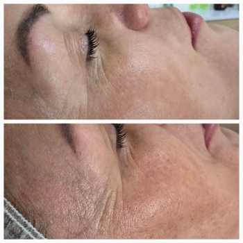 Фото из портфолио салона Косметичний кабінет (косметологический центр, Ровно)