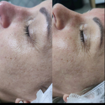 Фото из портфолио салона Косметичний кабінет (косметологический центр, Ровно)