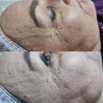 Фото из портфолио салона Косметичний кабінет (косметологический центр, Ровно)