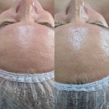 Фото из портфолио салона Косметичний кабінет (косметологический центр, Ровно)