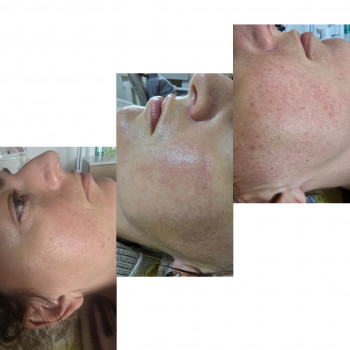 Фото из портфолио салона Косметичний кабінет (косметологический центр, Ровно)