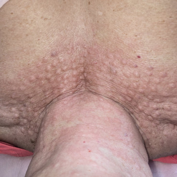 Фото из портфолио салона Косметичний кабінет (косметологический центр, Ровно)