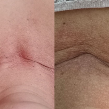 Фото из портфолио салона Косметичний кабінет (косметологический центр, Ровно)