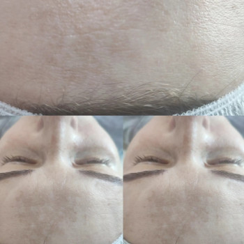 Фото из портфолио салона Косметичний кабінет (косметологический центр, Ровно)