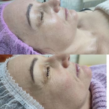 Фото из портфолио салона Косметичний кабінет (косметологический центр, Ровно)