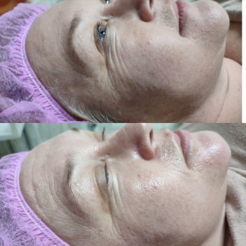 Фото из портфолио салона Косметичний кабінет (косметологический центр, Ровно)