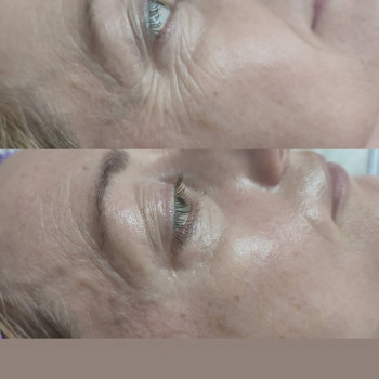 Фото из портфолио салона Косметичний кабінет (косметологический центр, Ровно)