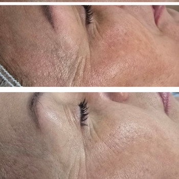 Фото из портфолио салона Косметичний кабінет (косметологический центр, Ровно)