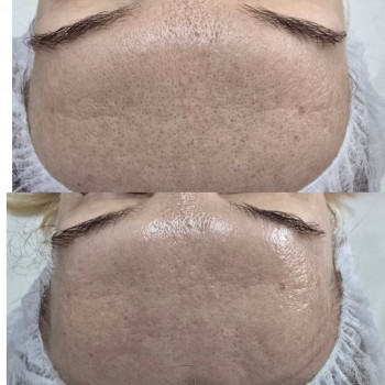 Фото из портфолио салона Косметичний кабінет (косметологический центр, Ровно)