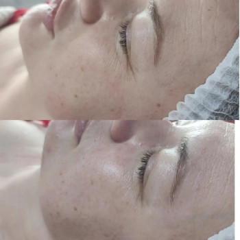 Фото из портфолио салона Косметичний кабінет (косметологический центр, Ровно)