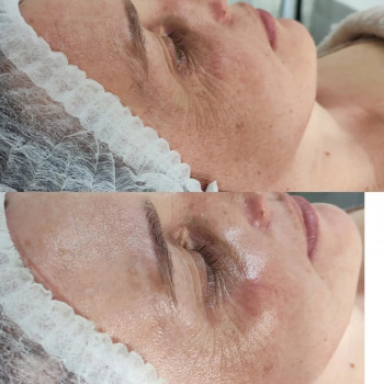 Фото из портфолио салона Косметичний кабінет (косметологический центр, Ровно)