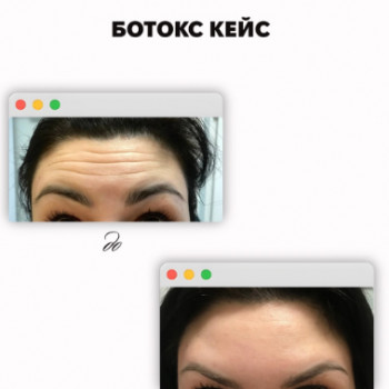 Sweet Skin, Киев Фото - 5