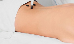  Физиотерапевт  Черновцы