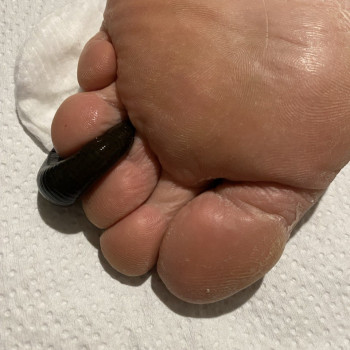 Фото з портфоліо фахівця Олена Боднар (фізіотерапевт, Чернівці)