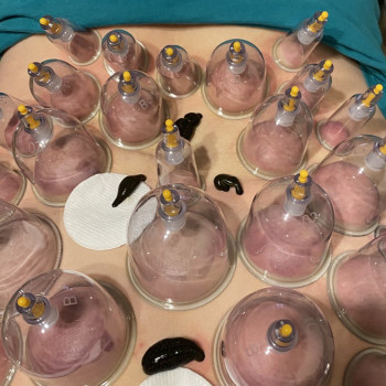 Фото з портфоліо фахівця Олена Боднар (фізіотерапевт, Чернівці)