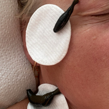 Фото з портфоліо фахівця Олена Боднар (фізіотерапевт, Чернівці)