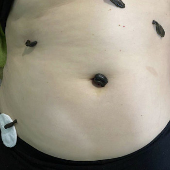 Фото з портфоліо фахівця Олена Боднар (фізіотерапевт, Чернівці)