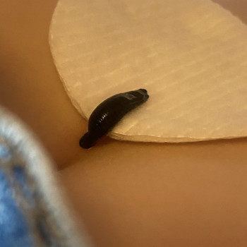 Фото з портфоліо фахівця Олена Боднар (фізіотерапевт, Чернівці)